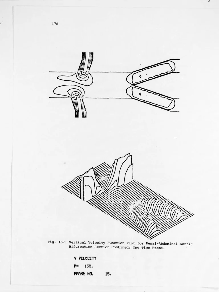 An illustration from An Application of Computer Graphics: Two Concurrent Investigations Within the Medical Field,, 1971, leaf 203