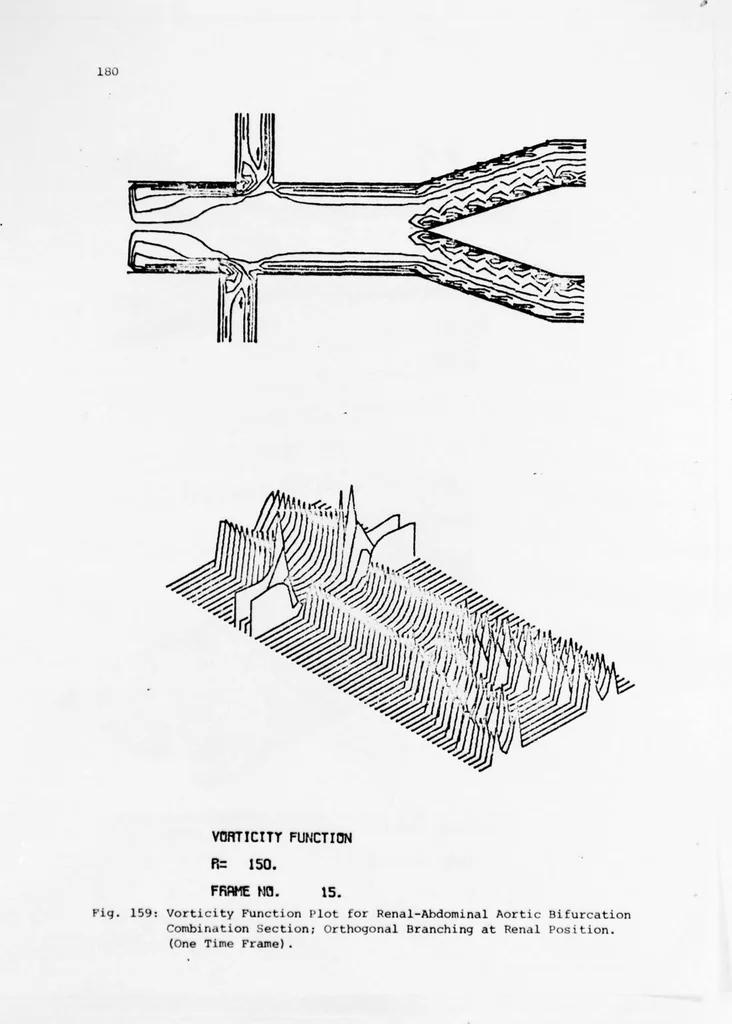 An illustration from An Application of Computer Graphics: Two Concurrent Investigations Within the Medical Field,, 1971, leaf 205