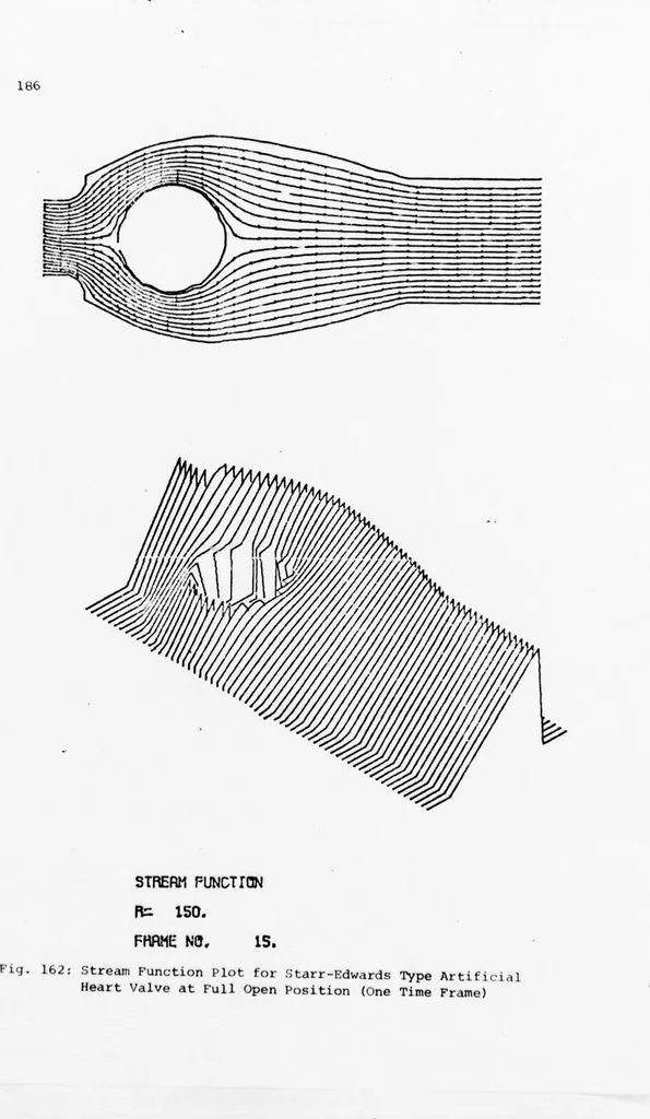 An illustration from An Application of Computer Graphics: Two Concurrent Investigations Within the Medical Field,, 1971, leaf 211