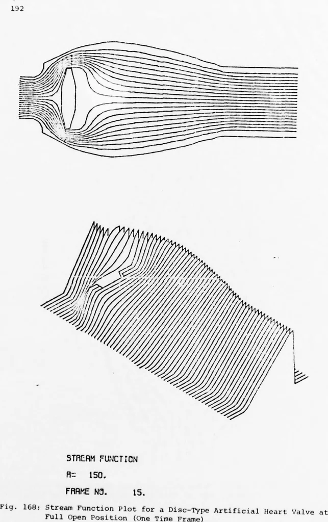 An illustration from An Application of Computer Graphics: Two Concurrent Investigations Within the Medical Field,, 1971, leaf 217
