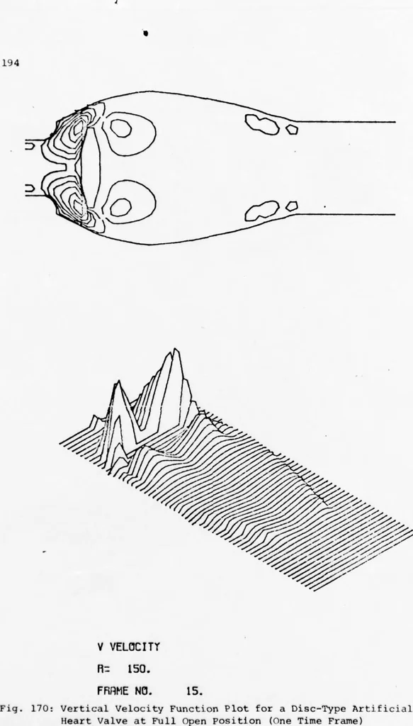 An illustration from An Application of Computer Graphics: Two Concurrent Investigations Within the Medical Field,, 1971, leaf 219