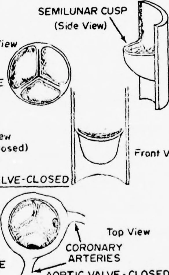 An illustration from An Application of Computer Graphics: Two Concurrent Investigations Within the Medical Field,, 1971, leaf 29
