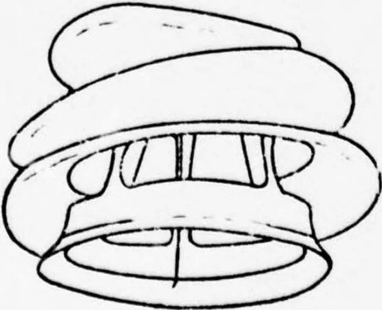 An illustration from An Application of Computer Graphics: Two Concurrent Investigations Within the Medical Field,, 1971, leaf 41