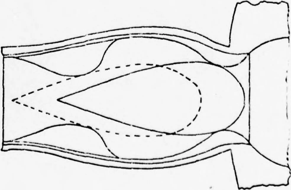 An illustration from An Application of Computer Graphics: Two Concurrent Investigations Within the Medical Field,, 1971, leaf 46