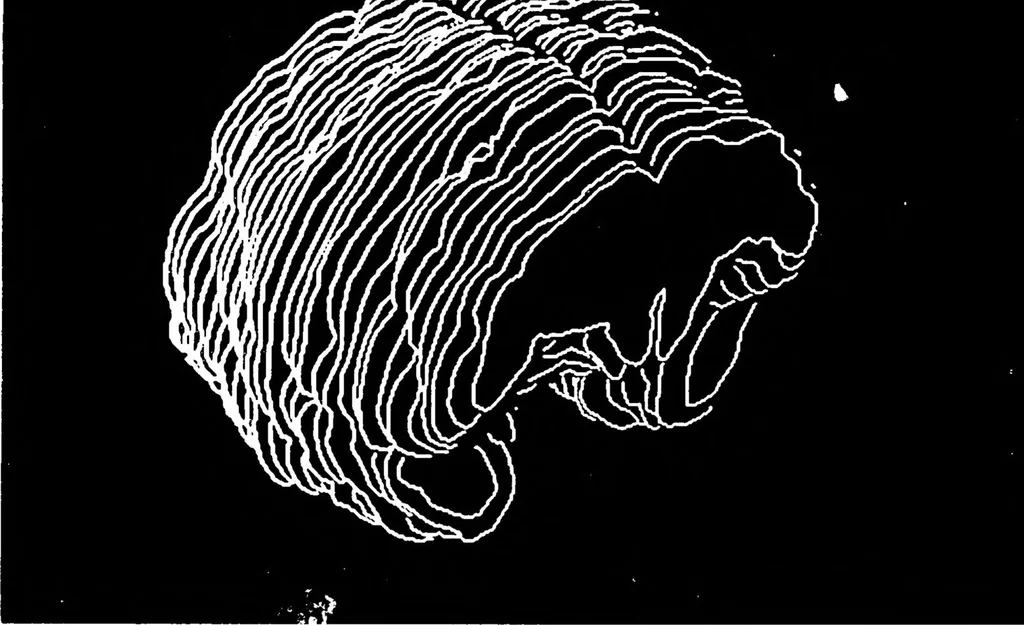An illustration from Three-Dimensional Computer Graphics Brain-Mapping Project, 1988, leaf 100