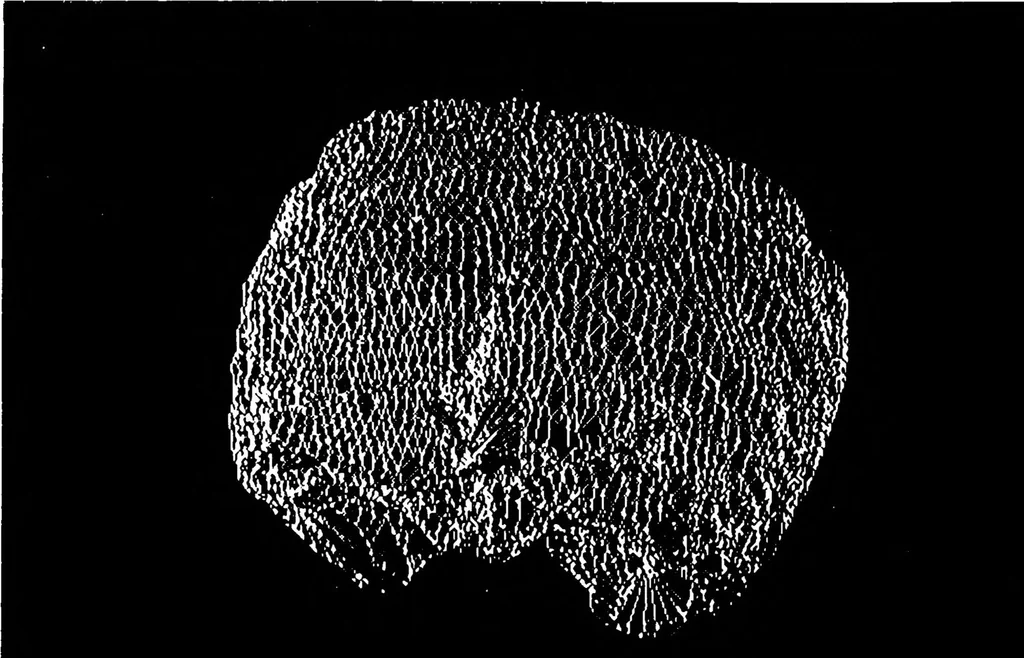 An illustration from Three-Dimensional Computer Graphics Brain-Mapping Project, 1988, leaf 100