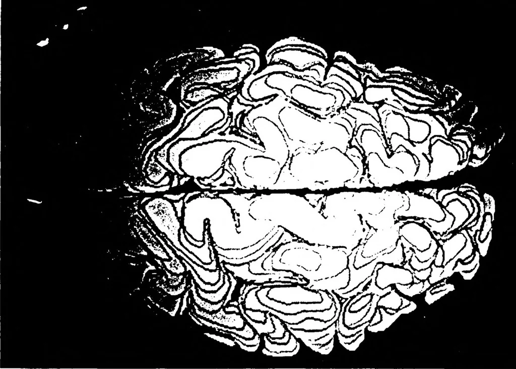 An illustration from Three-Dimensional Computer Graphics Brain-Mapping Project, 1988, leaf 109