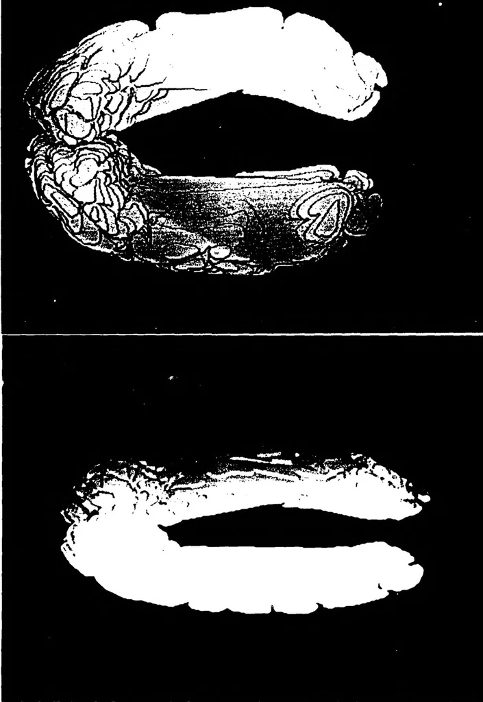 An illustration from Three-Dimensional Computer Graphics Brain-Mapping Project, 1988, leaf 111