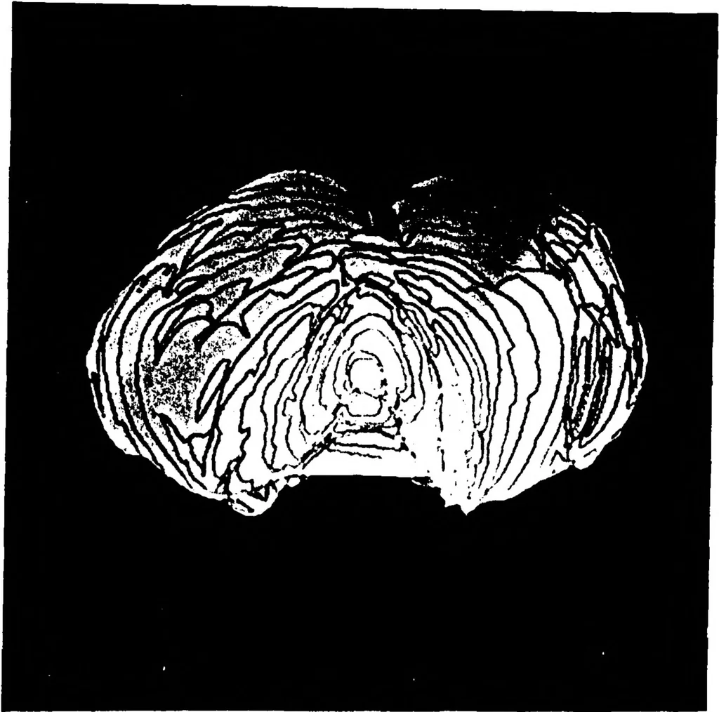 An illustration from Three-Dimensional Computer Graphics Brain-Mapping Project, 1988, leaf 113