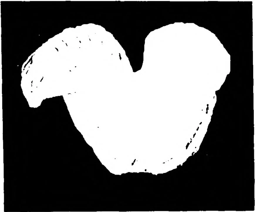 An illustration from Three-Dimensional Computer Graphics Brain-Mapping Project, 1988, leaf 119