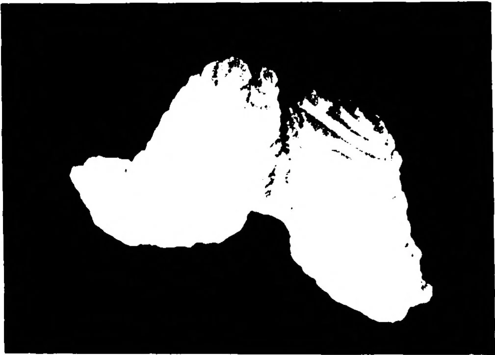 An illustration from Three-Dimensional Computer Graphics Brain-Mapping Project, 1988, leaf 119