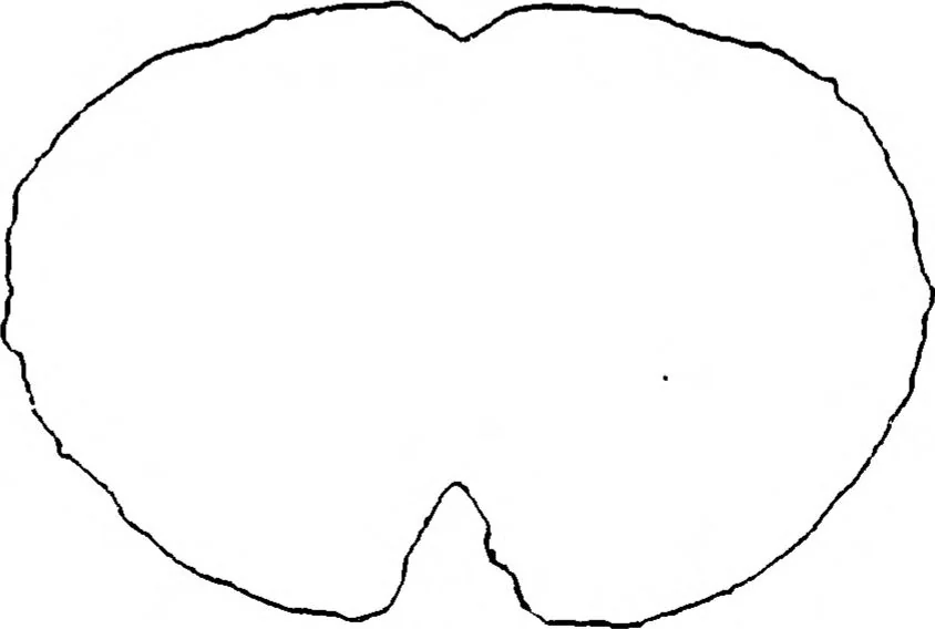An illustration from Three-Dimensional Computer Graphics Brain-Mapping Project, 1988, leaf 75
