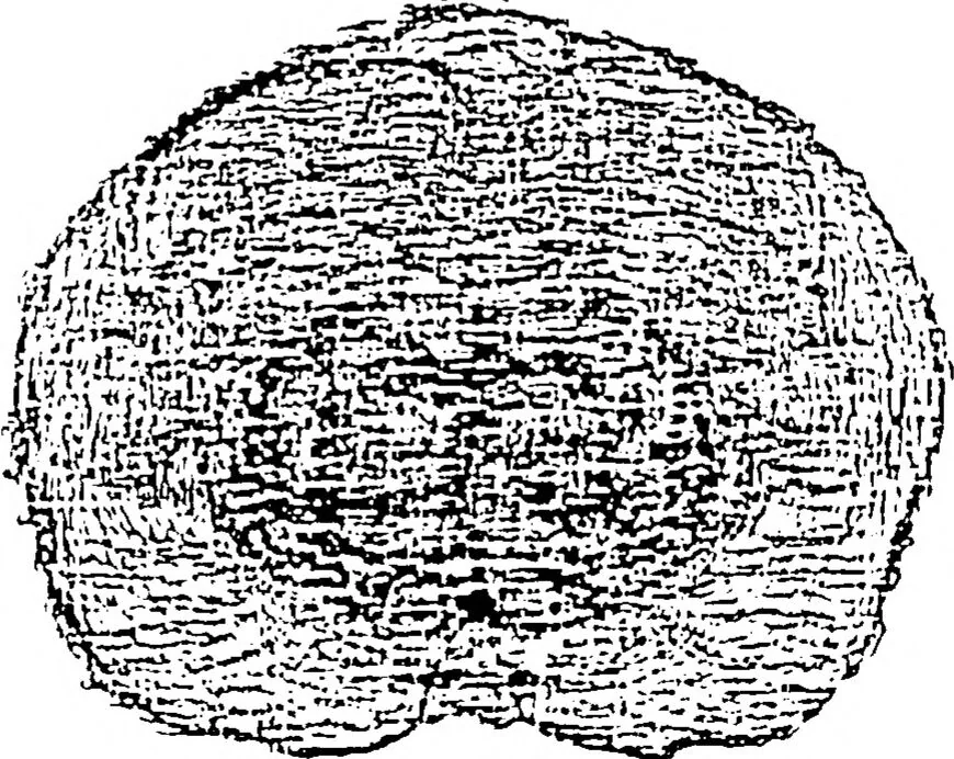 An illustration from Three-Dimensional Computer Graphics Brain-Mapping Project, 1988, leaf 79