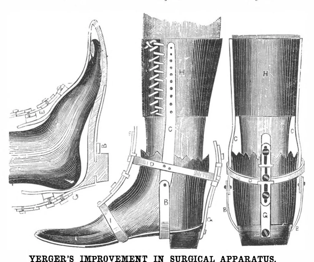 An illustration from Scientific American, Vol. 6, No. 10 (1862), 1862, leaf 3