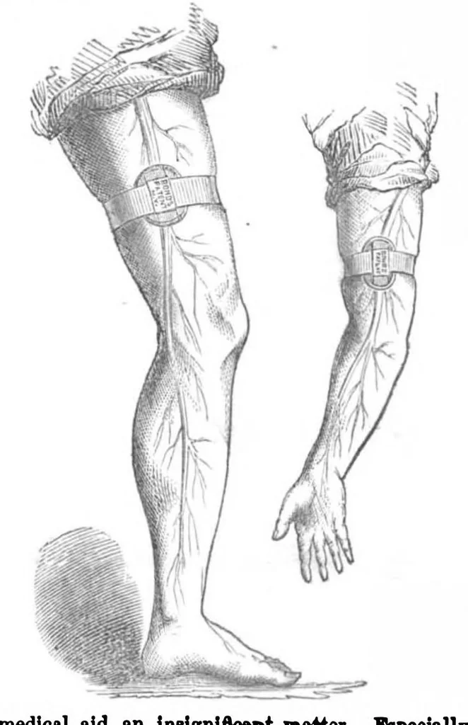 An illustration from Scientific American, Vol. 8, No. 20 (1863), 1863, leaf 2