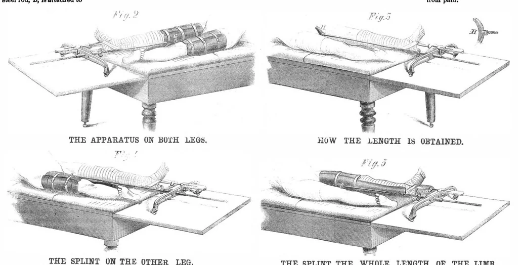 An illustration from Scientific American, Vol. 14, No. 17 (1866), 1866, leaf 0