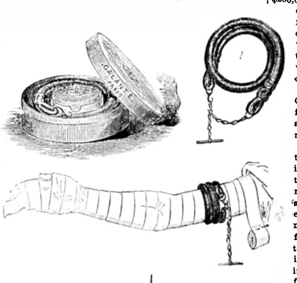 An illustration from Scientific American, Vol. 31, No. 1 (1874), 1874, leaf 5