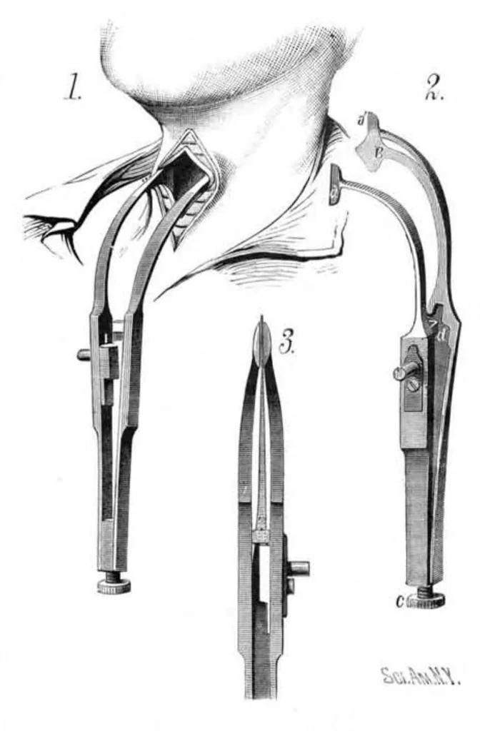 An illustration from Scientific American, Vol. 46, No. 22 (1882), 1882, leaf 3