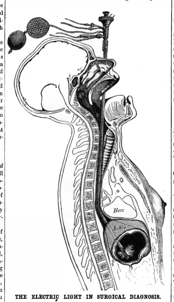 An illustration from Scientific American, Vol. 48, No. 15 (1883), 1883, leaf 8