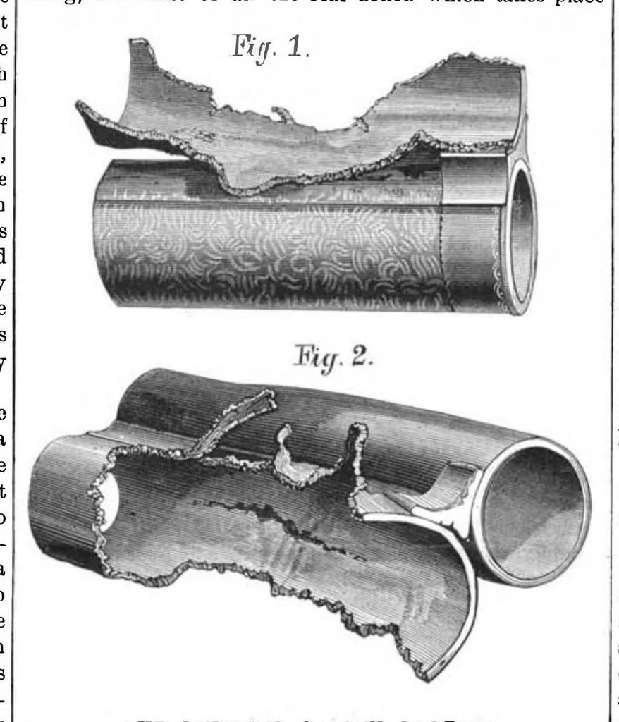 An illustration from Scientific American, Vol. 50, No. 19 (1884), 1884, leaf 8