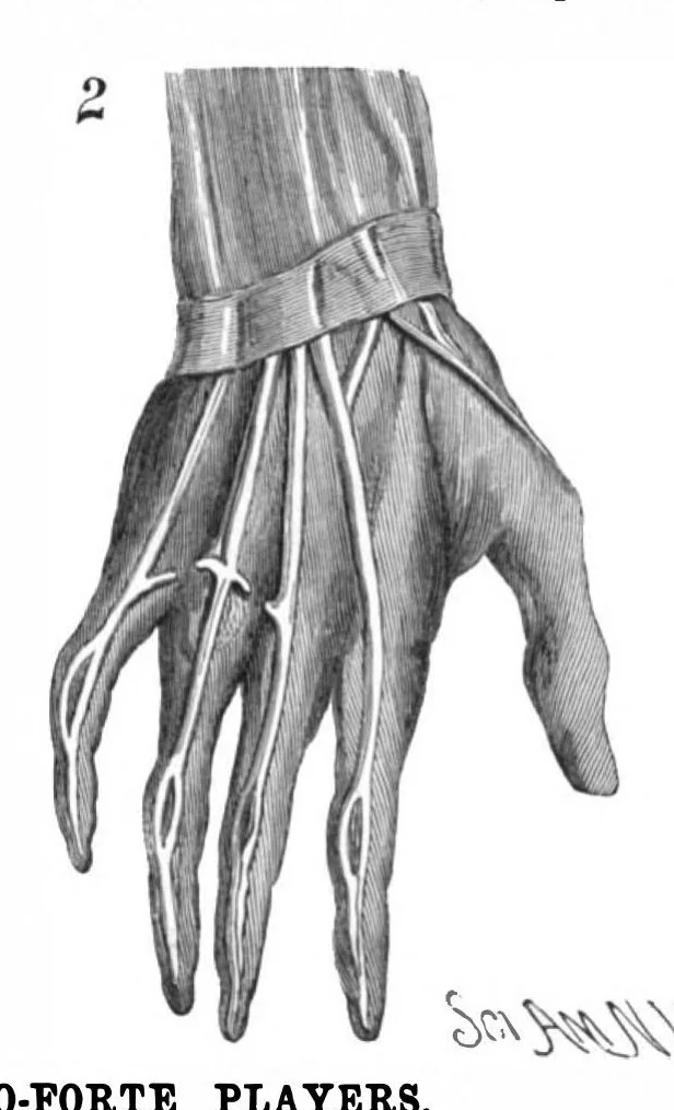 An illustration from Scientific American, Vol. 53, No. 6 (1885), 1885, leaf 7