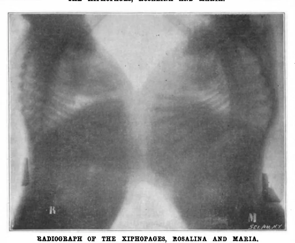 An illustration from Scientific American, Vol. 82, No. 8 (1900), 1900, leaf 10