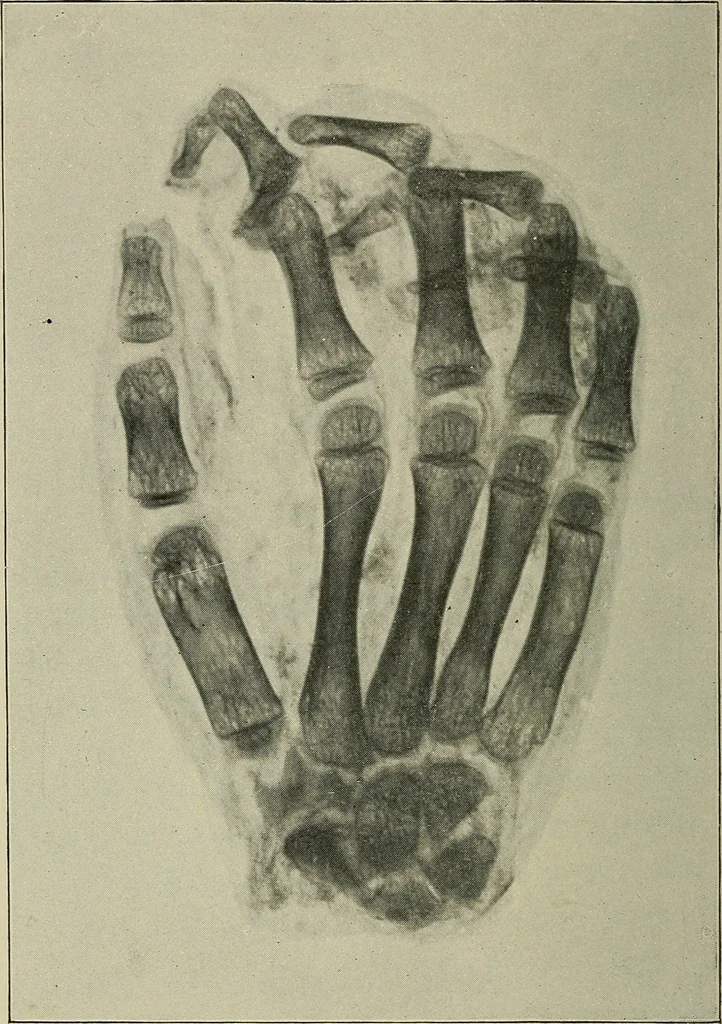 An illustration from The ABC of the X rays, 1896, leaf 121