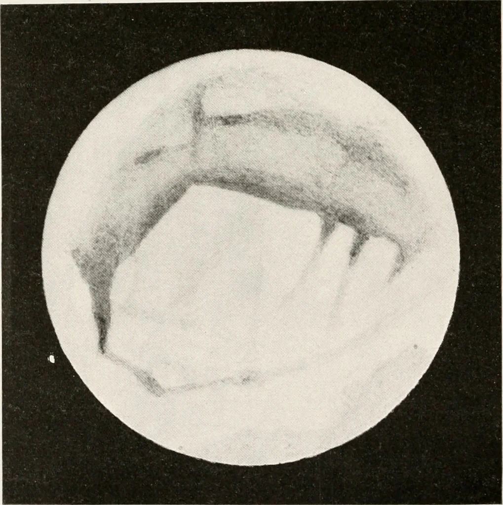 An illustration from The Adolfo Stahl lectures in astronomy, delivered in San Francisco, California, in 1916-17 and 1917-18, under the auspices of the Astronomical Society of the Pacific, 1919, leaf 45