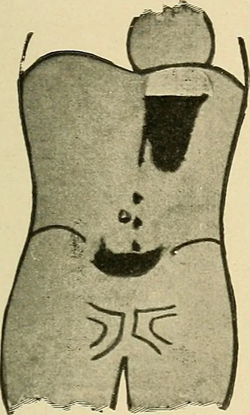 An illustration from The alimentary tract : a radiographic study, 1915, leaf 114