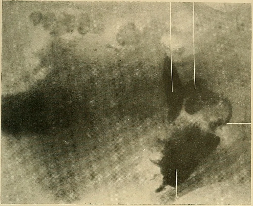 An illustration from The alimentary tract : a radiographic study, 1915, leaf 160