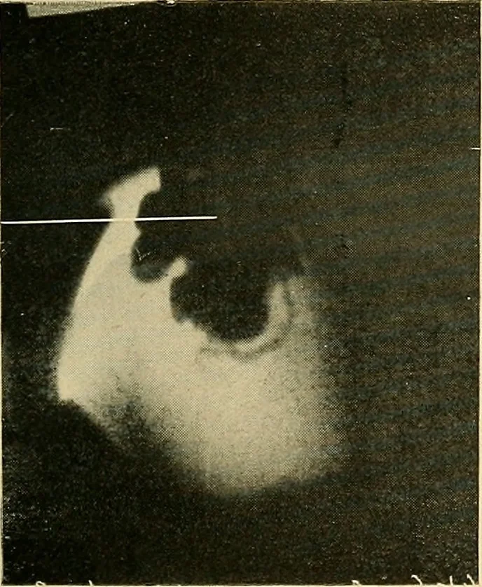 An illustration from The alimentary tract : a radiographic study, 1915, leaf 192