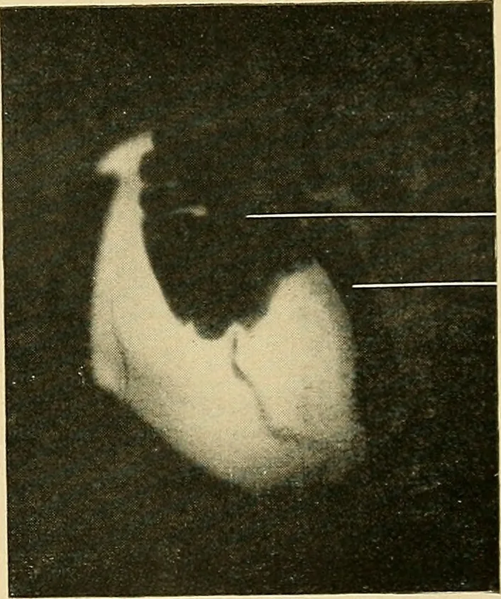 An illustration from The alimentary tract : a radiographic study, 1915, leaf 192