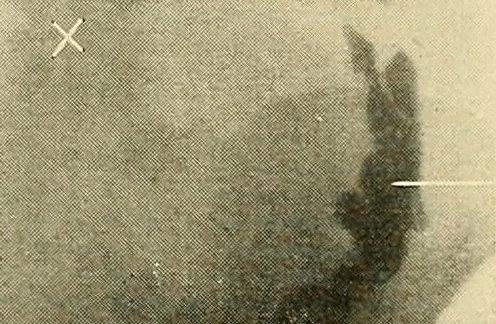 An illustration from The alimentary tract : a radiographic study, 1915, leaf 204