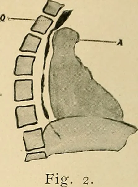 An illustration from The alimentary tract : a radiographic study, 1915, leaf 49
