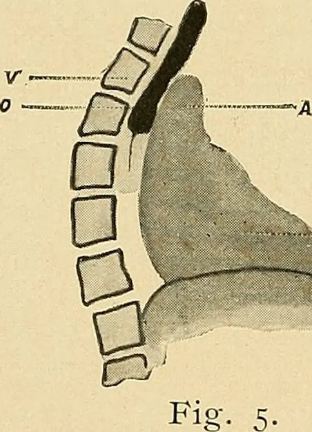 An illustration from The alimentary tract : a radiographic study, 1915, leaf 49
