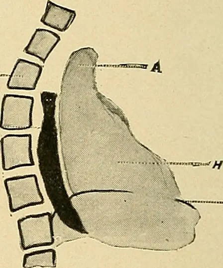 An illustration from The alimentary tract : a radiographic study, 1915, leaf 49