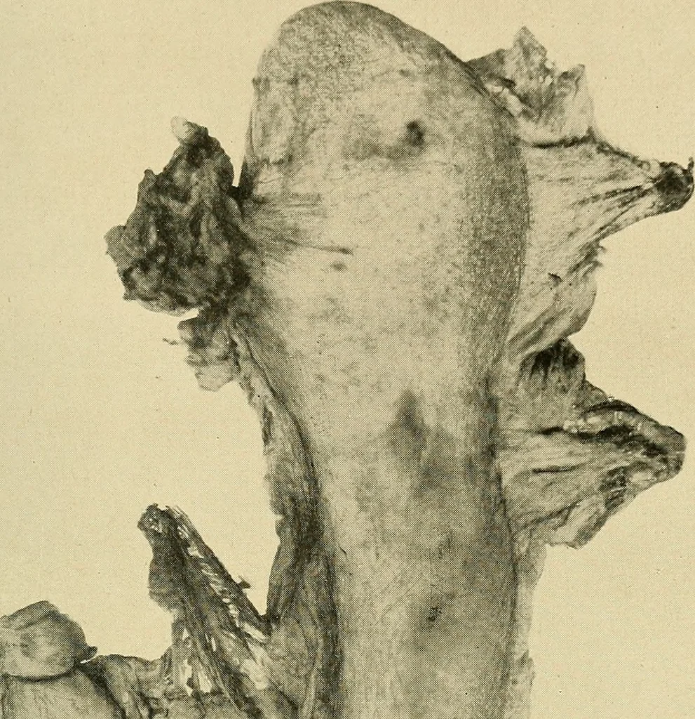 An illustration from The alimentary tract : a radiographic study, 1915, leaf 66