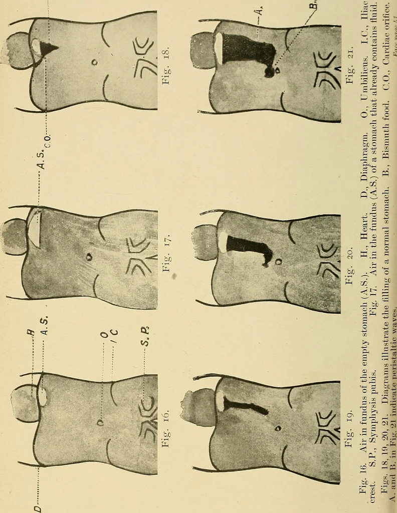 An illustration from The alimentary tract : a radiographic study, 1915, leaf 69
