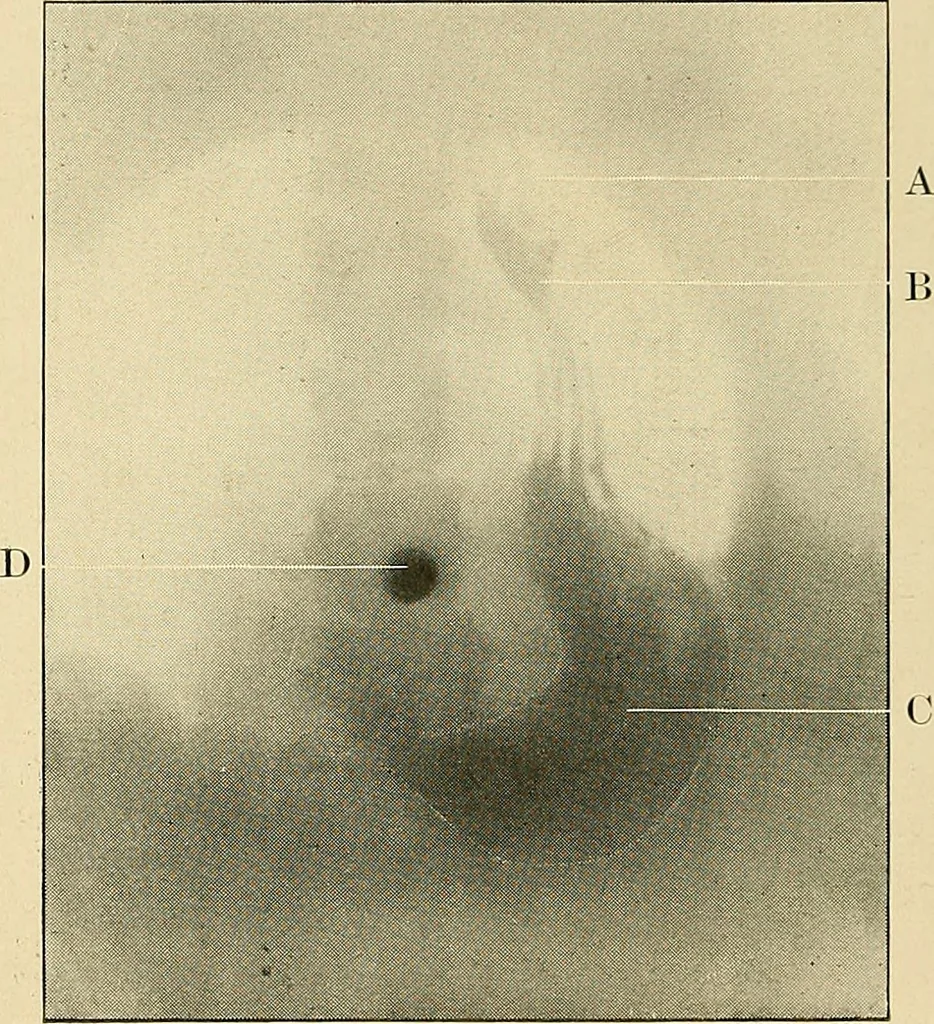An illustration from The alimentary tract : a radiographic study, 1915, leaf 97