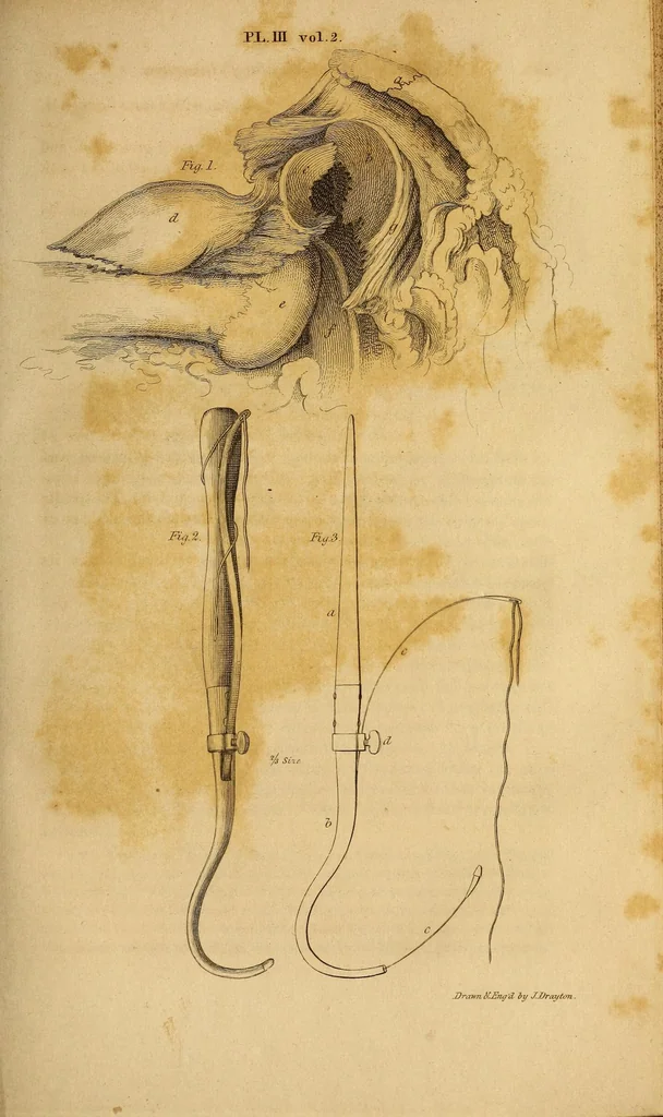 An illustration from The American journal of the medical sciences, 1827, leaf 699