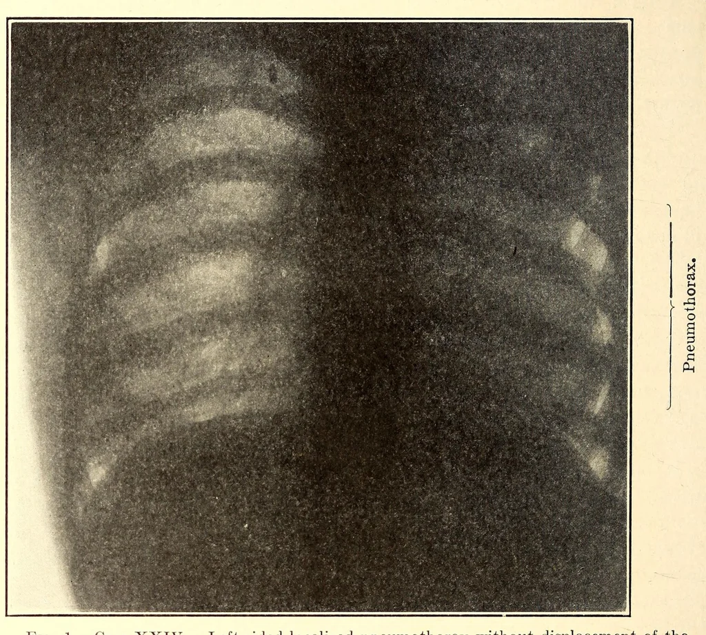 An illustration from The American journal of the medical sciences, 1827, leaf 132