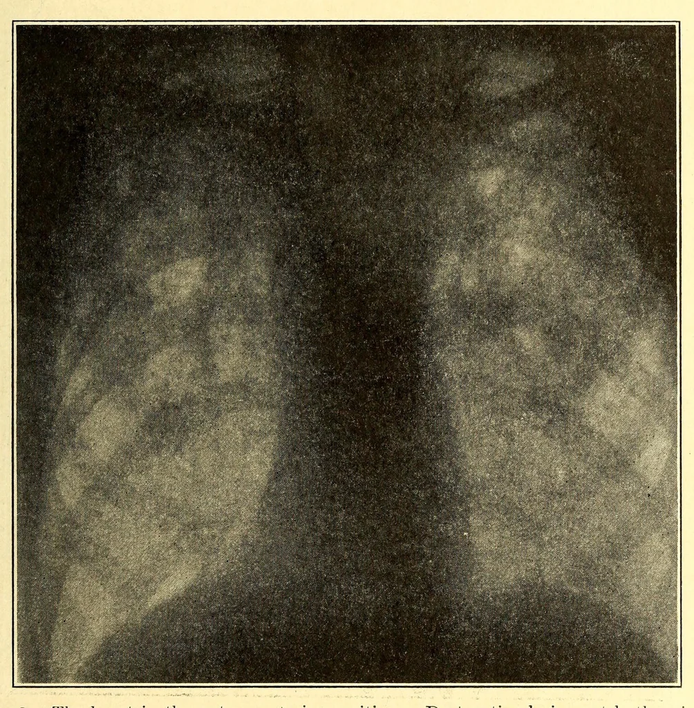 An illustration from The American journal of the medical sciences, 1827, leaf 133