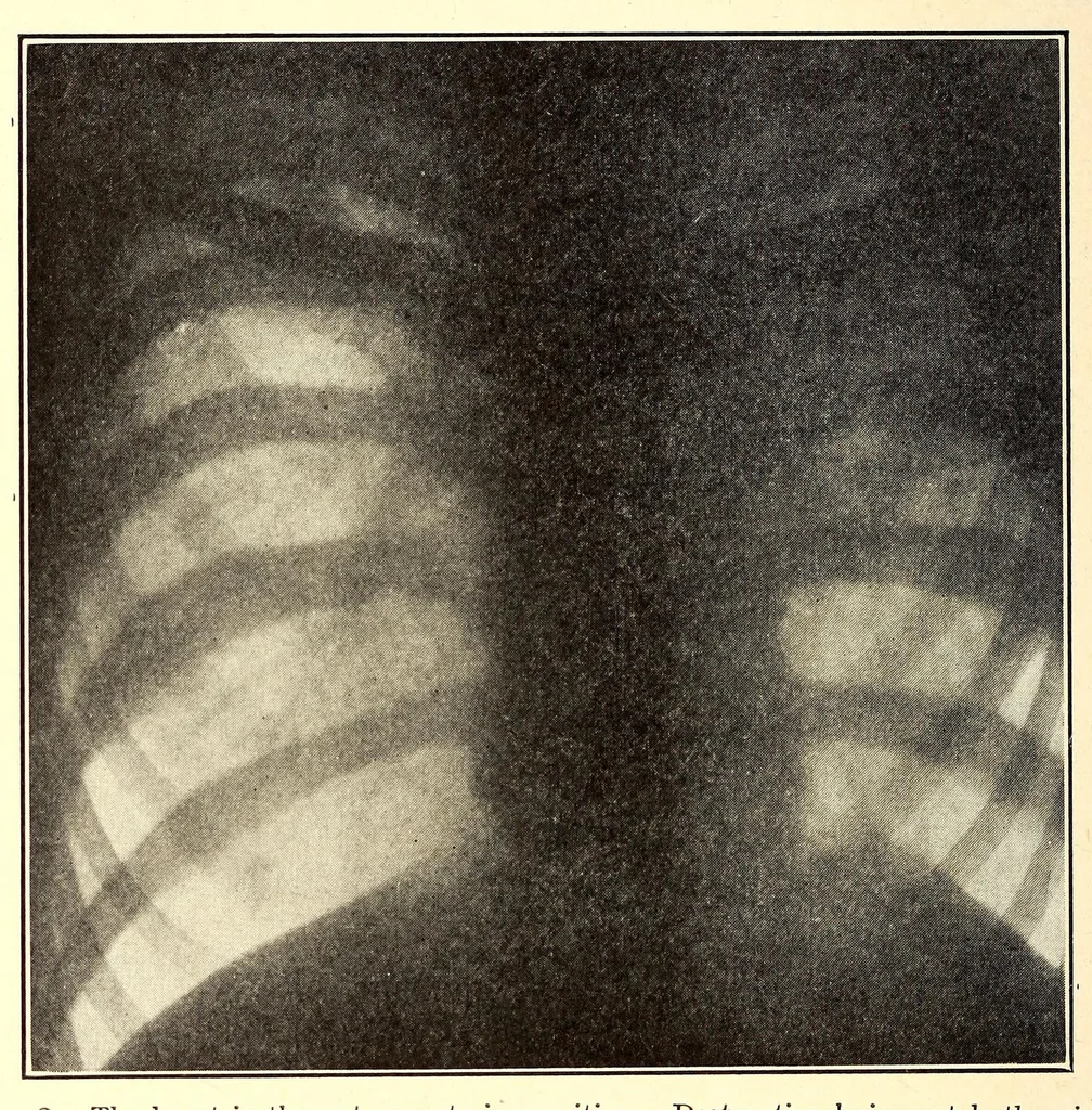 An illustration from The American journal of the medical sciences, 1827, leaf 134