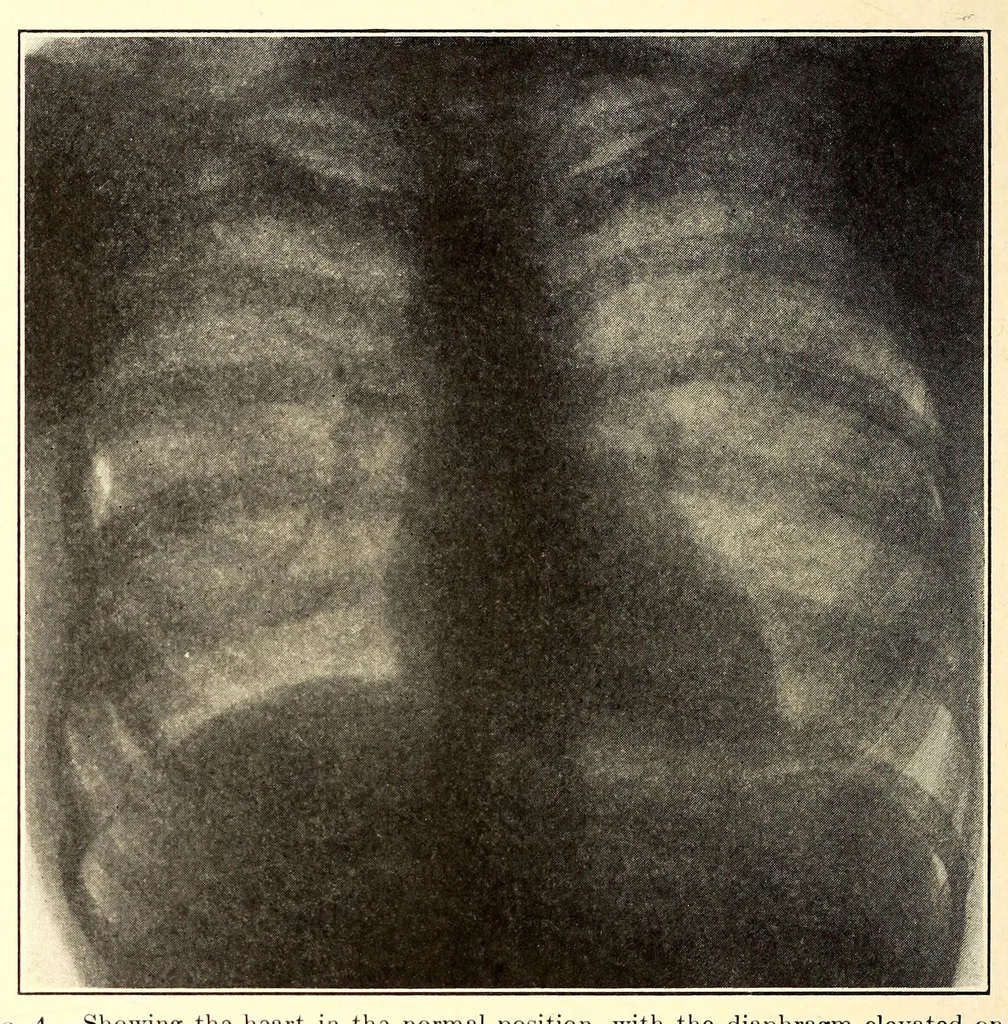 An illustration from The American journal of the medical sciences, 1827, leaf 136