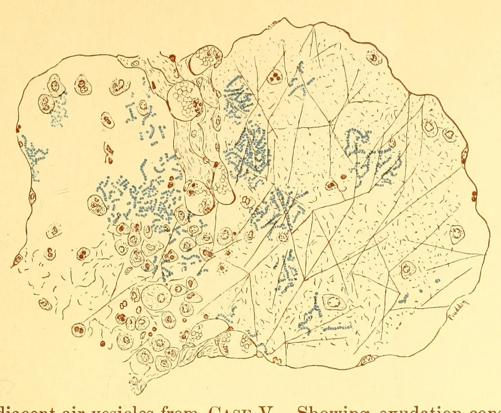 An illustration from The American journal of the medical sciences, 1827, leaf 37