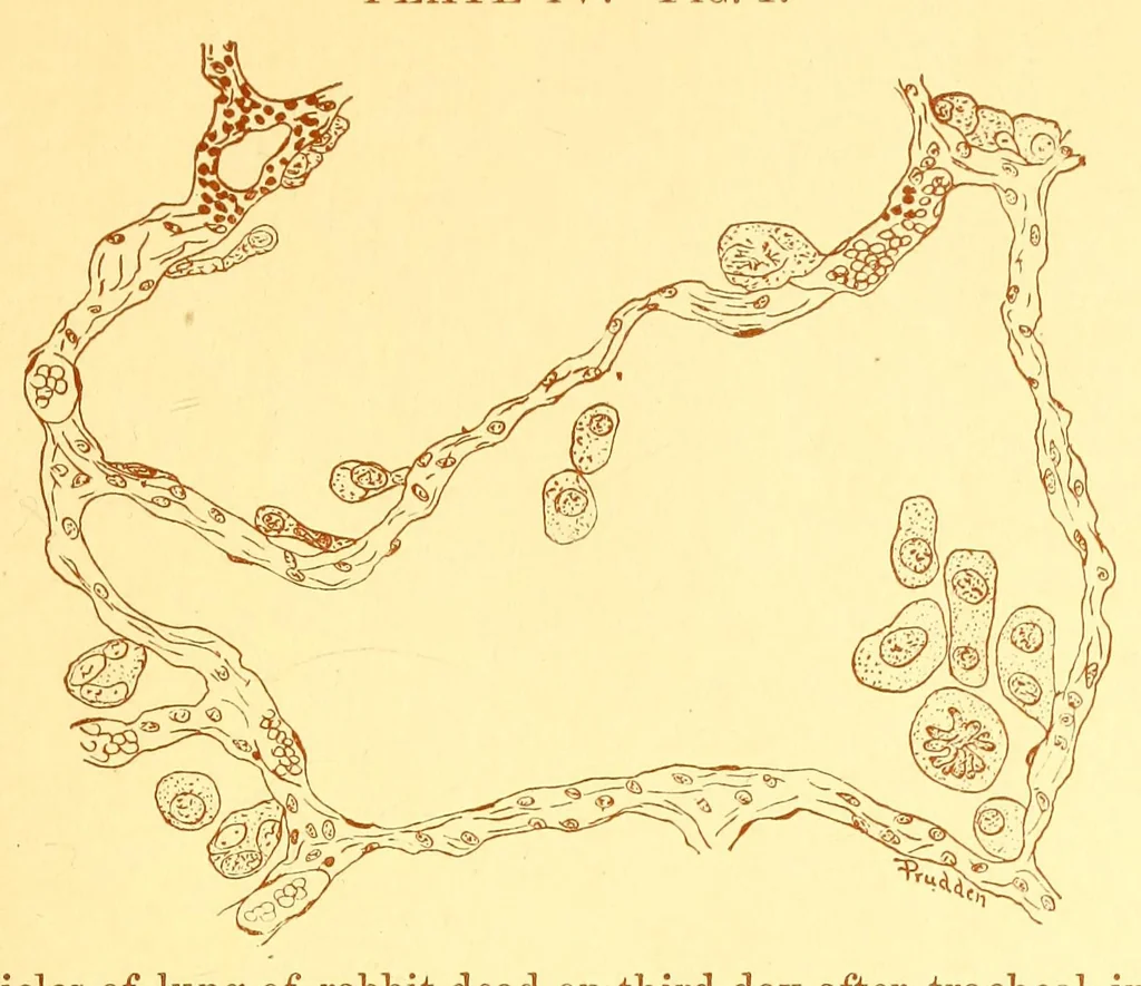 An illustration from The American journal of the medical sciences, 1827, leaf 45