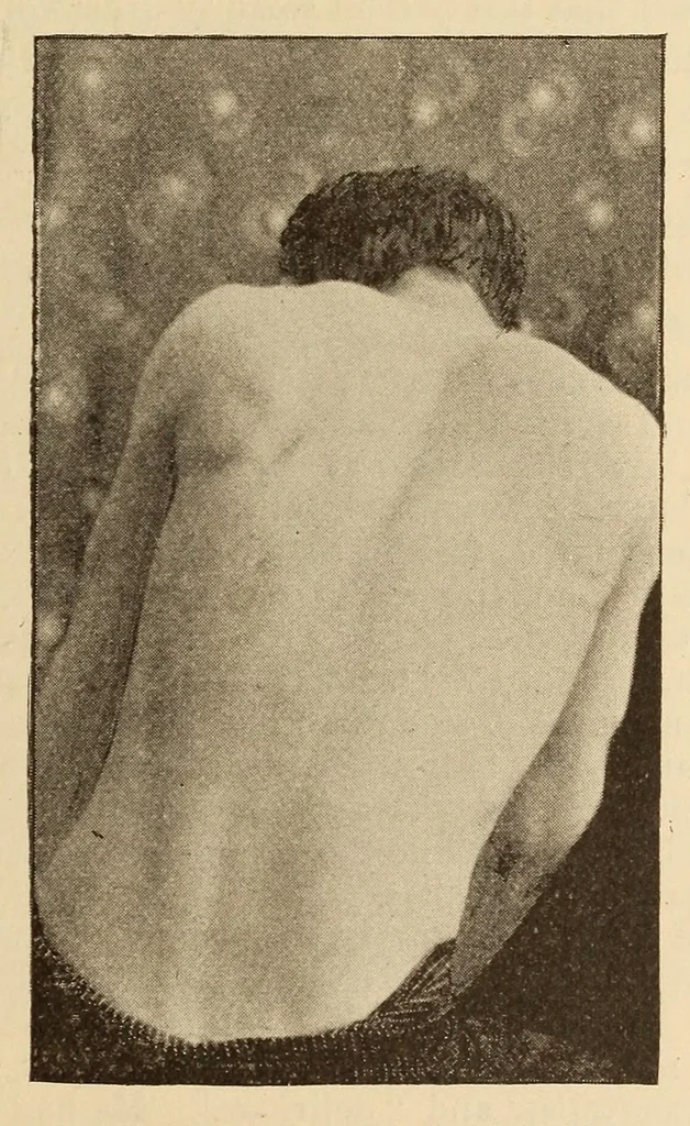 An illustration from The American journal of the medical sciences, 1827, leaf 335