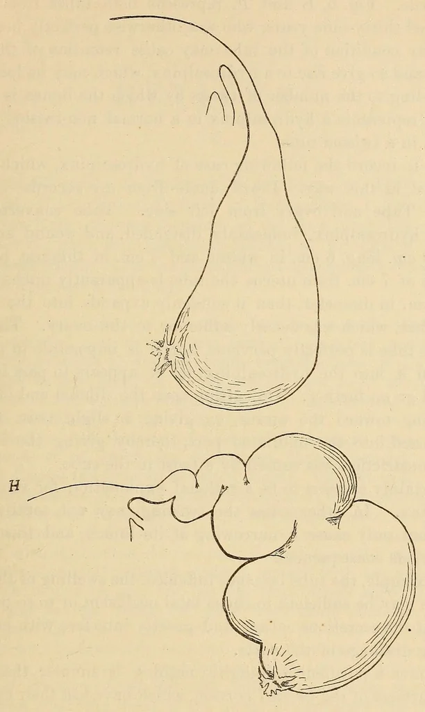 An illustration from The American journal of the medical sciences, 1827, leaf 497