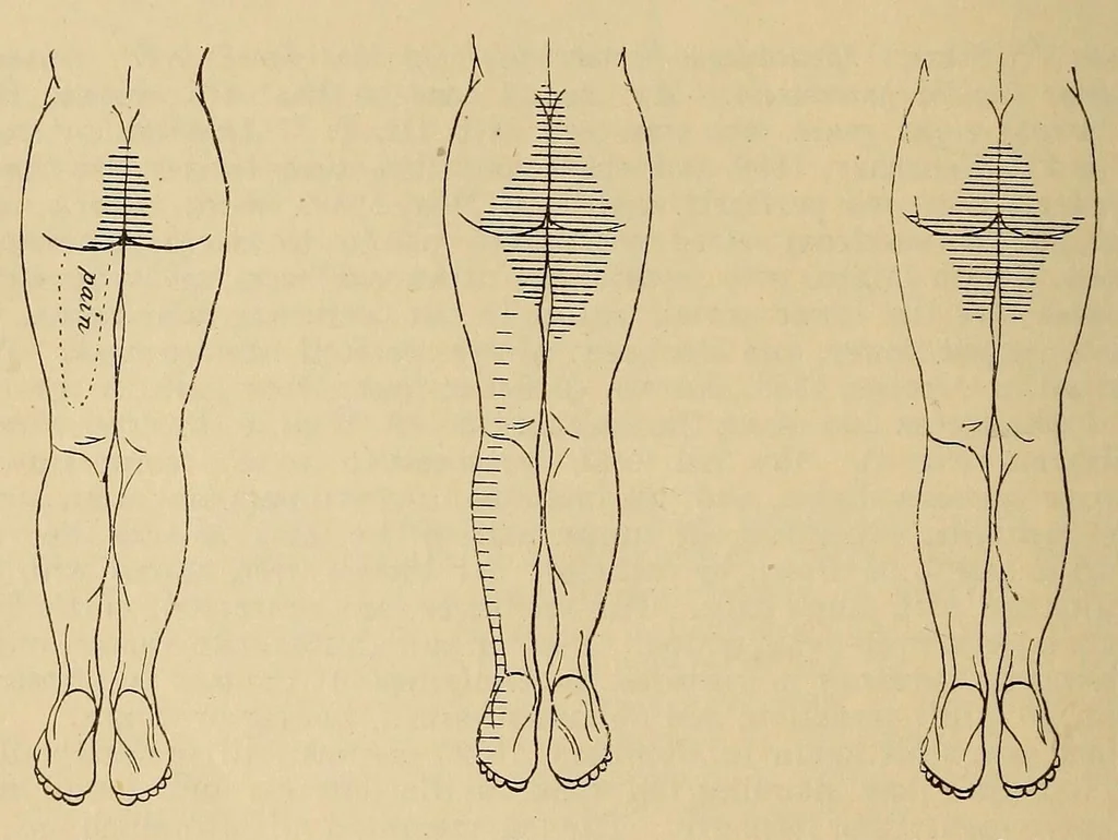 An illustration from The American journal of the medical sciences, 1827, leaf 40