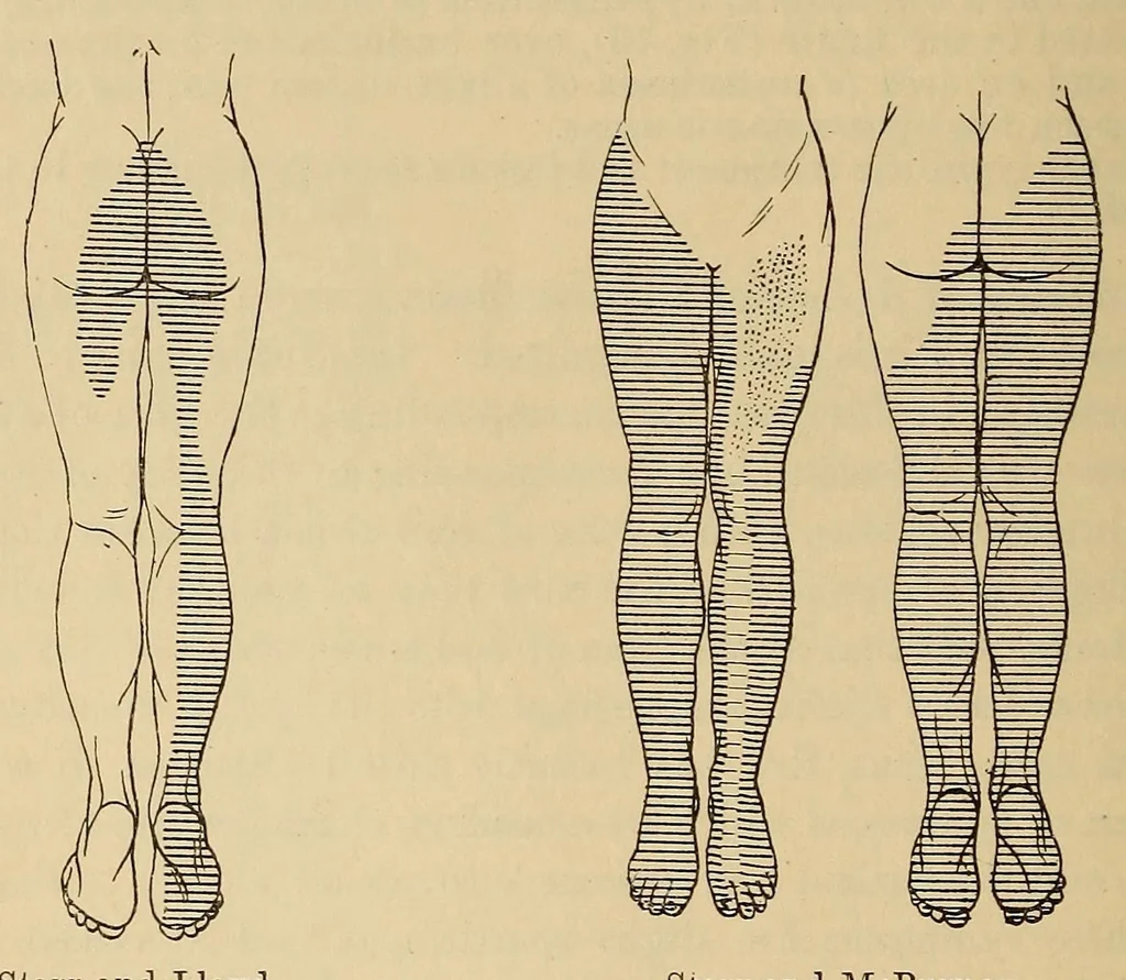 An illustration from The American journal of the medical sciences, 1827, leaf 46